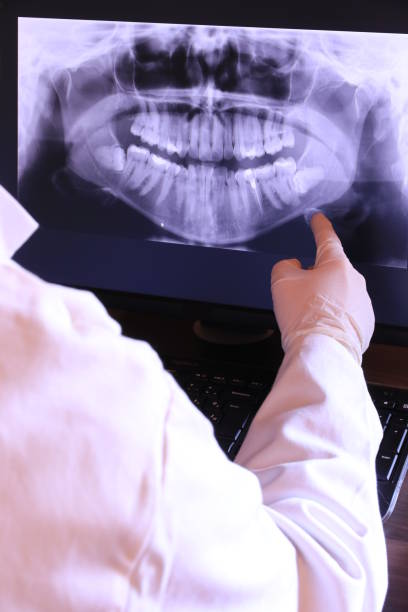 Best Weekend Emergency Dentist in Beardstown, IL