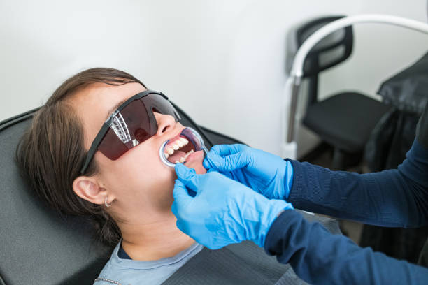 Best Emergency Root Canal Treatment in Beardstown, IL